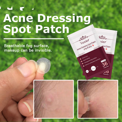 Acne Spot Patch Set